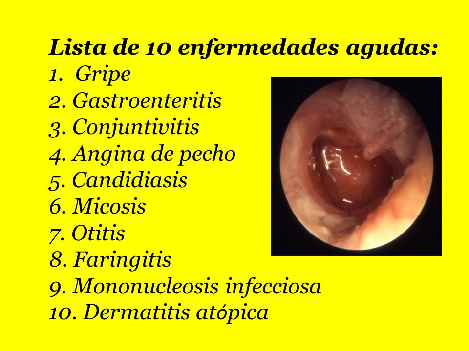 4 tipos de infecciones 4 tipos de infecciones